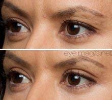 Eye Magic Original Eye Lift Kit (Small/Medium Size With Gel) Lifts Eyelid Droop and Hooded Eyes | Open And Show Off Your Beautiful Eyes | Made In America-Velvo Beauty