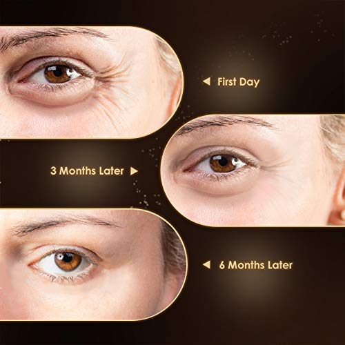 Anti Aging Eye Cream, Retinol Eye Cream Contains Niacinamide and Hyaluronic Acid, Reduces Wrinkles, Puffiness, Crows Feet and Dark Circles, 1 Oz-Velvo Beauty