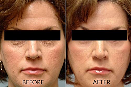 Vitamin C Serum 20% Pure L-Ascorbic Acid, Ferulic Acid, Vitamin E and Hyaluronic Acid for Face and Eyes Natural Anti Aging Anti Wrinkle 1oz. by Dr. Brenner-Velvo Beauty