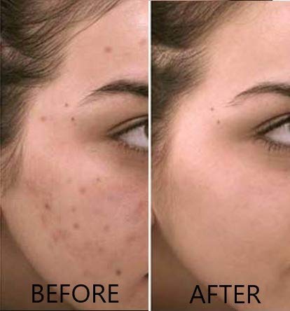Vitamin C Serum 20% Pure L-Ascorbic Acid, Ferulic Acid, Vitamin E and Hyaluronic Acid for Face and Eyes Natural Anti Aging Anti Wrinkle 1oz. by Dr. Brenner-Velvo Beauty