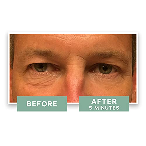 Instant Eye Lift - Eye Cream to Visibly Reduce Fines Lines, Crow's Feet, Puffiness, and Dark Circles Instantly and Over Time (0.5 FL. OZ.).-Velvo Beauty