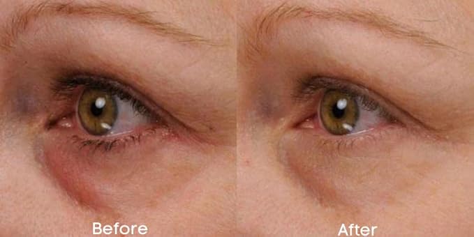 Renew & Firm Eye Serum-Velvo Beauty