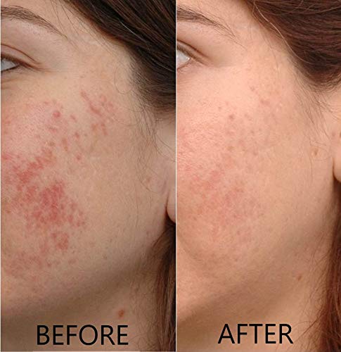 Vitamin C Serum 20% Pure L-Ascorbic Acid, Ferulic Acid, Vitamin E and HA and Hyaluronic Acid Serum with Vitamin B5 for Face and Eyes Natural Anti Aging Anti Wrinkle Set of 2 by Dr. Brenner-Velvo Beauty