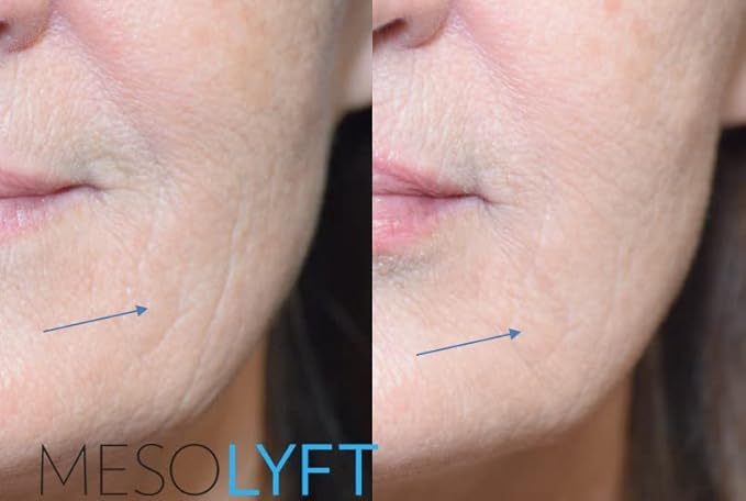Anti-Aging Serum with Neck & Eyes Combo Skincare Face Serum Reduce Signs of Aging Roller for Face An Effective Treatment for Neck and Eyes-Velvo Beauty