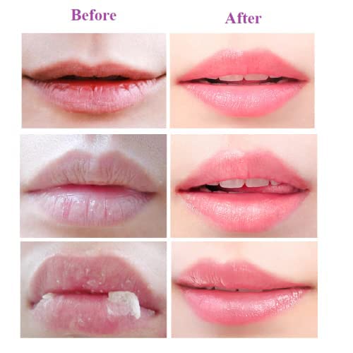 2PCS Lip Balm Honey Pot,Propolis Moisturizing Honey Lip Mask Lip Balm,Hydrating & Prevention Dry and Cracked Lip Scrubs Exfoliator-Velvo Beauty