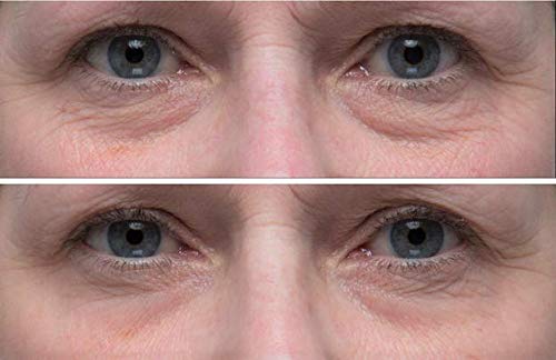 Dr. Denese SkinScience HydroShield Eye Emulsion Increased Hydration with Botanical Stem Cells, Sodium PCA, Watermelon Extract, Ceramides & Amino Acids - Improve the Look of Lines & Wrinkles - 1oz-Velvo Beauty