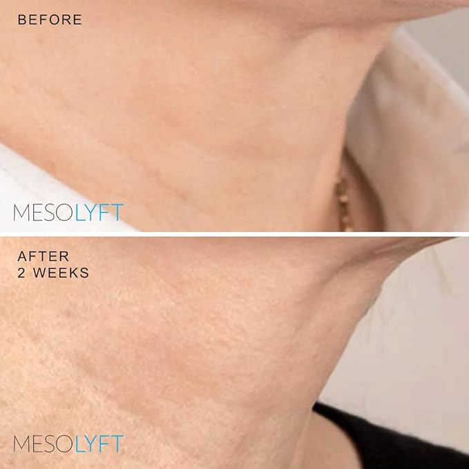 Neck & Eyes Combo Skincare Tool under Eye Serum With Neck Line Remover Neck and Décolletage Beuty Tool & Under Eye Wrinkle Filler Exfoliates the Skin, Visibly Firm & Smooth Necklines-Velvo Beauty