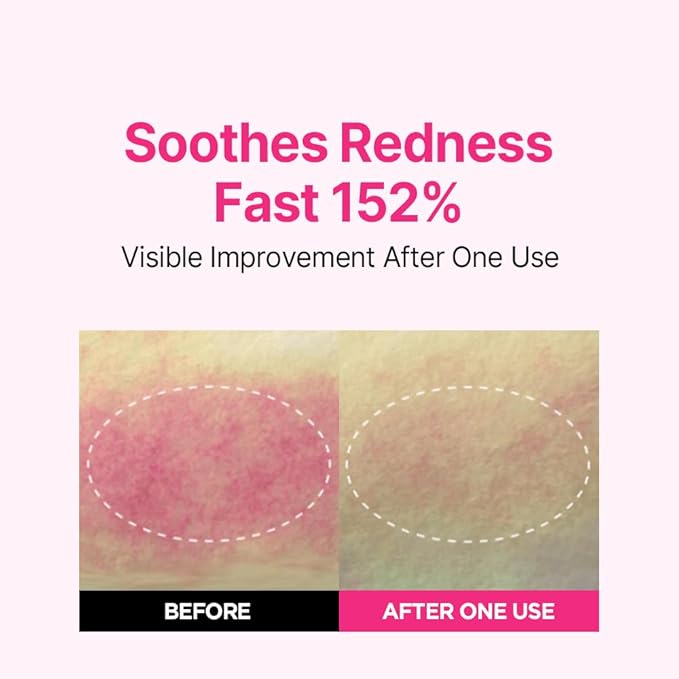 ISOI Blemish Care Up Serum for Face, Vegan Hydrating Serum for Smooth & Glass Skin Effect, Skin Barrier & Moisture Balance for Women, Korean Skin Care (0.85 fl. oz, 25ml)-Velvo Beauty