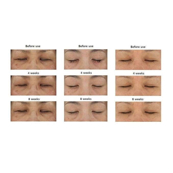 Fermentation Peptine Eye Care Cream 45ml /1.52oz with 8 peptide K-beauty Tube Type…-Velvo Beauty
