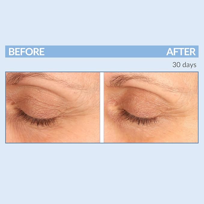 Serious Skincare - Eyetality Morning Total Eye Care Cream - For Lines, Wrinkles, Under Eye Puffiness and Dark Circles - Coffee Bean Extract - Vitamin C - Pomegranate - 0.5 oz-Velvo Beauty