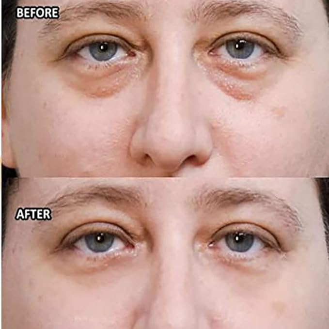Wow-IT Instant Under Eye Cream,Ream For Eye Bags,Remove Under Eye Bags Instantly,Anti-Wrinkle Eye Cream,Helps To Instantly Reduce The Puffy Eye Look (3PCS)-Velvo Beauty