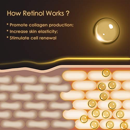Anti Aging Eye Cream, Retinol Eye Cream Contains Niacinamide and Hyaluronic Acid, Reduces Wrinkles, Puffiness, Crows Feet and Dark Circles, 1 Oz-Velvo Beauty