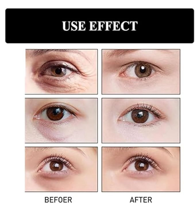 Berbax Instant Firm Eye Tightener, Berbax Eye Bag Cream, Berbax Dark Circle Eye Cream, Berbax Brightening Firming Eye Cream, Berbax Instant Firming Anti-Aging Eye Cream (1.05OZ)-Velvo Beauty