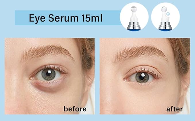 5% Caffeine Eye Serum, Under Eye Roller Cream for Dark Circles and Puffiness with 360°Massage Ball Reduce Wrinkles and Fine Lines,Bags Under Eyes,15ML-Velvo Beauty