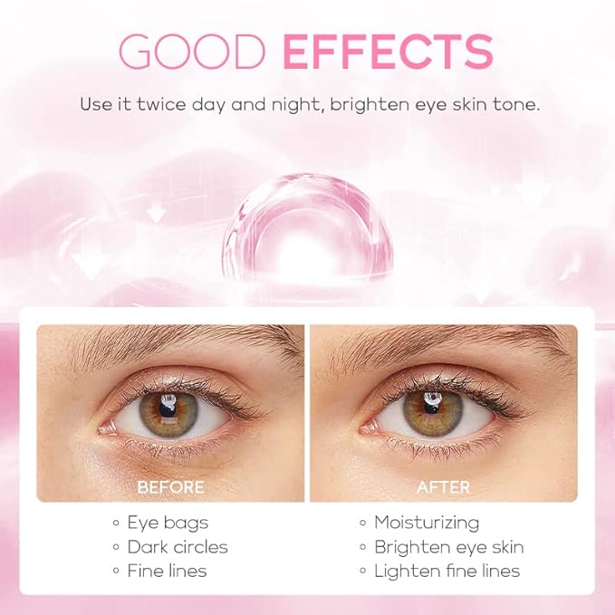 AKARY Cherry Blossom Eye Cream with Hyaluronic Acid, Lightweight Skincare Eye Cream for Dark Circles and Puffiness, Hydrating Under Eye Cream for All Skin Types, Cruelty-Free & Fragrance-Free-Velvo Beauty