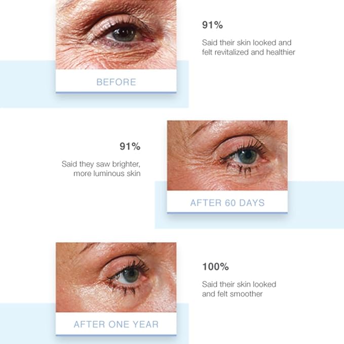 Elevate Eye Creme - With Age Defying Growth Factors Formulated To Address The Appearance Of Fine Lines And Wrinkles-Velvo Beauty