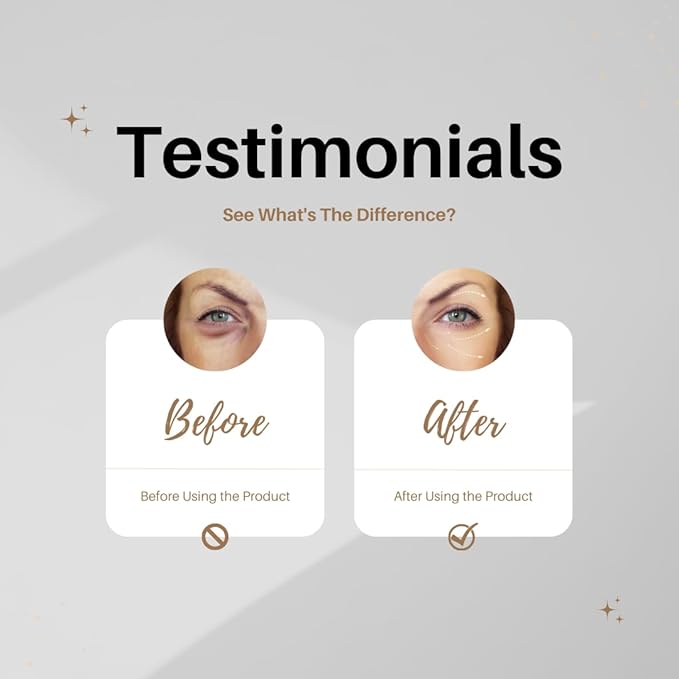 Eye Cream Peptide Snail Mucin Filtrates! NIACINAMIDE- Moisturizer, Brightening, Reduce Dark Circles & Wrinkles, Fine Lines, Sign of Aging. Made in Korea Skincare!-Velvo Beauty