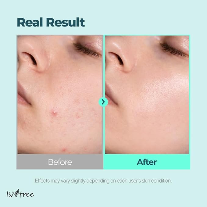 IsNtree Gim PDRN Deep Sleep Mask 80ml, 2.7 fl oz | Korean SEAWEED Skincare Sleeping Mask gel | Night Cream | Facial Mask | Overnight Gel mask for Hydration & Skin Bounce-Velvo Beauty
