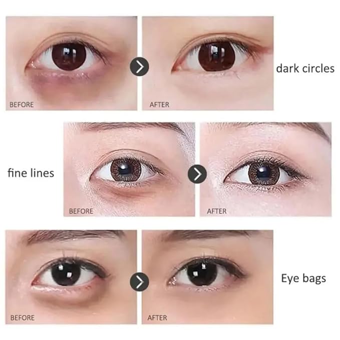 Time Eraser Rollerball, Retinol Anti-Wrinkle Eye Serum Oil, Eye Oil Roller, Reduces Fine Lines, Anti Wrinkle Serum For Eye-Velvo Beauty