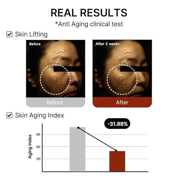Mito-on Cell Rejuvenation Anti-Aging Serum, 30ml / 1.01 fl.oz –10% Niacinamide, Vitamin B3 and Antioxidants, Centella + EGF for Anti-Aging, Wrinkle Reduction, Pore minimization, Korean Skin Care-Velvo Beauty