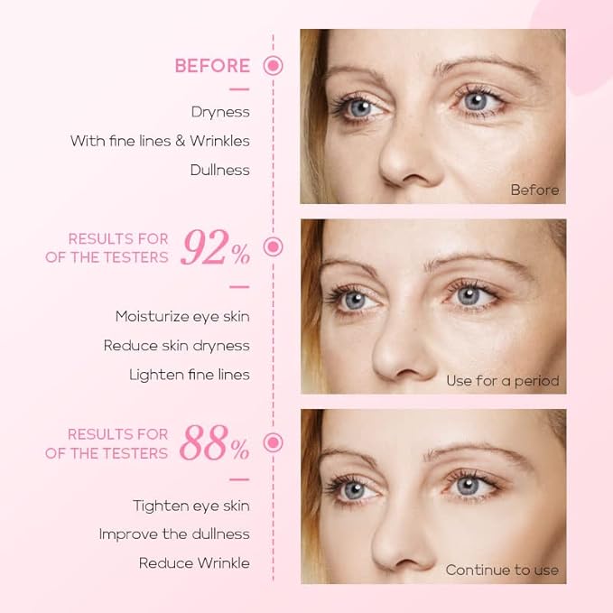 AKARY Cherry Blossom Eye Roller Serum Eye Moisturizer, Deep Hydration Eye Serum with Caffeine and Sodium Hyaluronate, Under Eye Cream to Reduce Dark Circles, Fine Lines, Smoothing Skin Care Treatment-Velvo Beauty