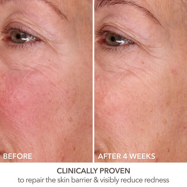 Dr Dennis Gross DermInfusions Fill + Repair Serum: Immediately Fills Lines, Plumps & Repairs, 1 oz-Velvo Beauty