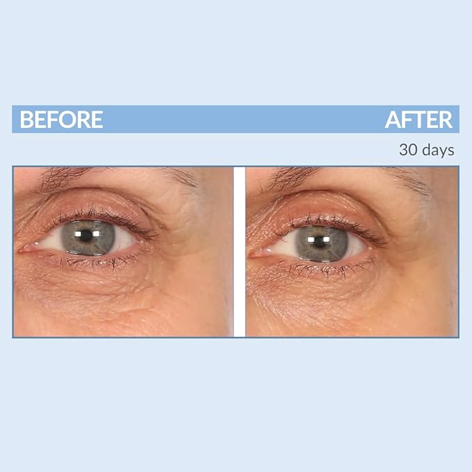 Serious Skincare - Eyetality Morning Total Eye Care Cream - For Lines, Wrinkles, Under Eye Puffiness and Dark Circles - Coffee Bean Extract - Vitamin C - Pomegranate - 0.5 oz-Velvo Beauty