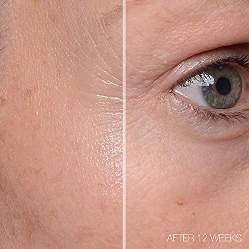 MD Complete Total Eye Treatment | Anti-Aging Hydrating Skin Renewal Eye Treatment | with Peptides, Vitamins C & E and Hyaluronic Acid for Wrinkles, Fine Lines and Crows Feet 0.5 fl oz-Velvo Beauty