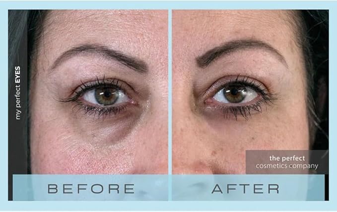 My Perfect Eyes 20ml, 200 Applications, Penny Lane, Instant Results, Clinically Proven, Anti-Ageing Serum UK Original Formula, Science-Backed Anti-Wrinkle Serum. As Seen on TV.-Velvo Beauty