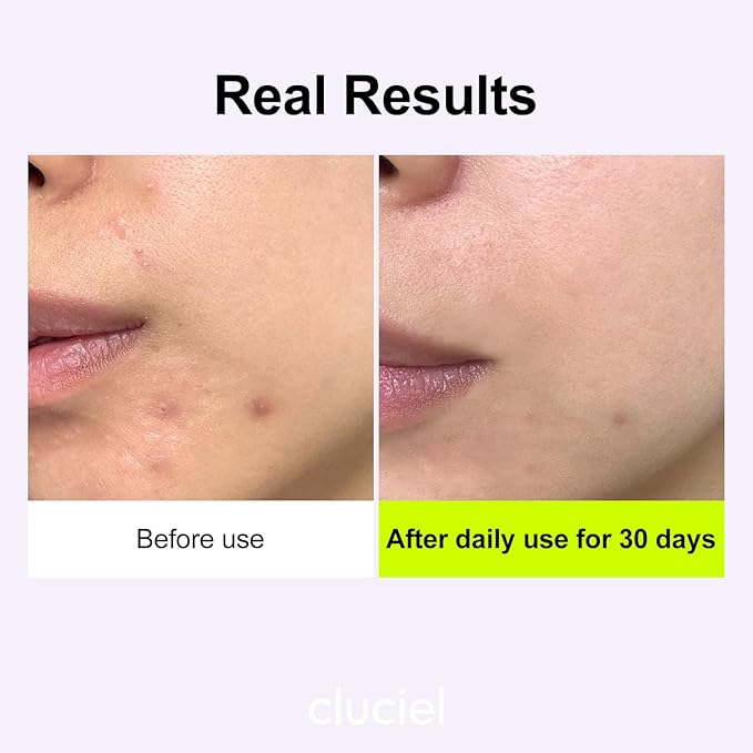 Niacinamide Peptide Serum I Repairing Serum, Targets Dullness, Dark Spots, Hyperpigmentation, Blemishes, Pore Care, Korean Glass skin (50ml / 1.69 fl.oz)-Velvo Beauty