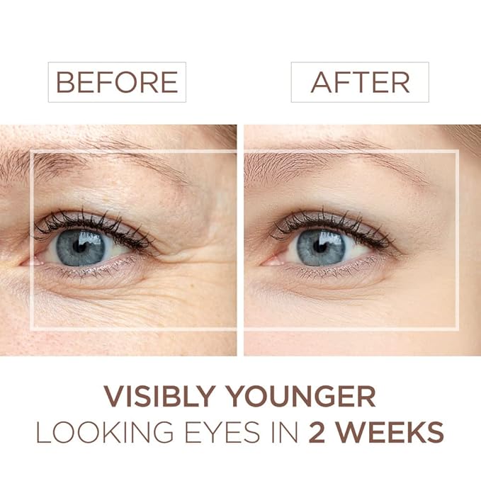 BEE and YOU Eye Cream, Anti Aging, Anti Wrinkle Serum 100% Natural with Bee Venom, Propolis Extract, Raw Honey, Hyaluronic Acid, For Dark Circles Under Eye Treatment and Puffiness, Skin Care, 15ml-Velvo Beauty