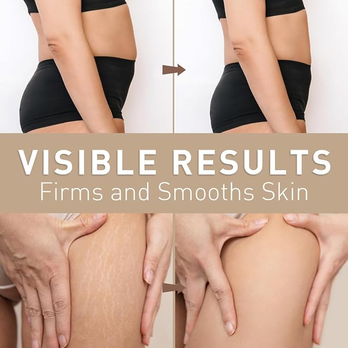 Belly Firming Cream: B Flat Skin Tightening Cream , Cellulite & Stretch Mark Reduction & Tummy Hips Cream & Body Firming for Stomach & Thighs & Arms – 3.38 Fl Oz-Velvo Beauty