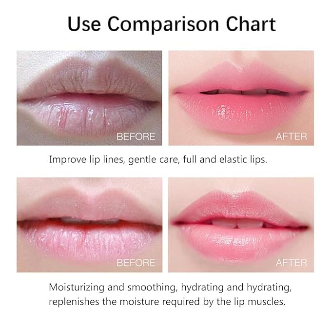 20Pcs Moisturizing/Plumping Lip Mask, Restores Moisture Mask for Dry Lips and Lines Overnight Care, Gel Treatment Masks (Pink)-Velvo Beauty