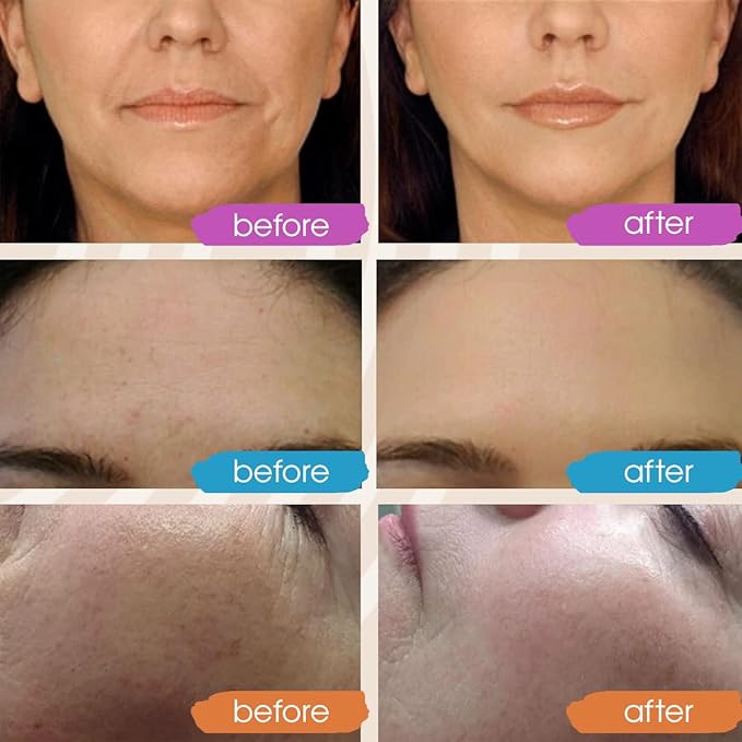 Retinol Serum for Face, Vitamin C with Hyaluronic Acid Face Serum for Women and Men, Glow Total Package Skin Care Set, Targets Appearance of Uneven Skin Tone and Dryness 3x2 oz-Velvo Beauty