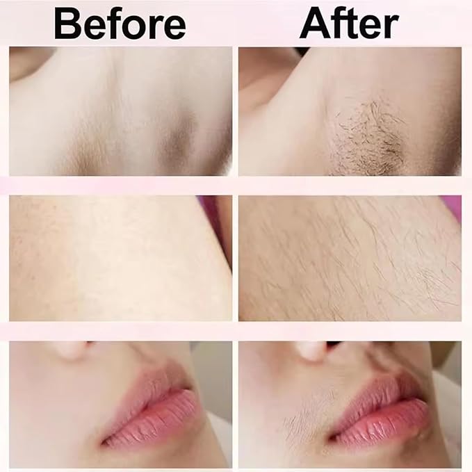 Dermave Bikini Shaver,2 in 1 Dual Head Bikini Trimmer & Body Shaver, Painless Hair Removal with Silky Glow Finish, Cordless & Waterproof Electric Trimmer for Women,Blue-Velvo Beauty