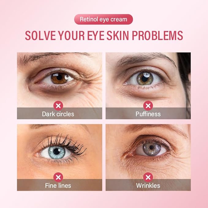 Retinol Eye Retinol Eye Cream for Dark Circles and Puffiness,Anti Aging Eye Cream with Collagen and Hyaluronic Acid,Smoothes Fine Lines,Firms and Lifts Eye Skin,Deeply Moisturizing-Velvo Beauty