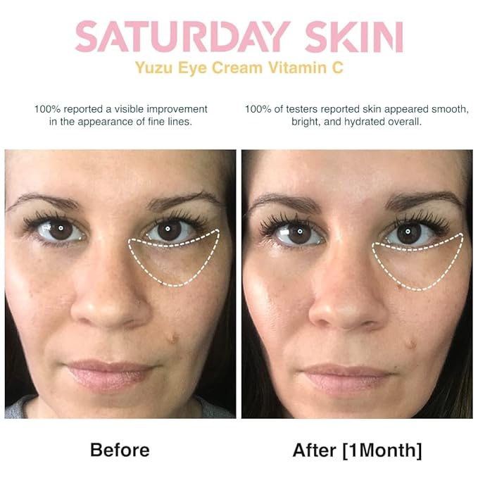 Saturday Skin Yuzu Eye Balm Vitamin C Wide lluminating Under Tight Eye Cream Korean Niacinamide Caffeine for Wrinkles Puffy Eyes Dark Circles Moisturizing Hydrates Anti Aging for Women (15ml)-Velvo Beauty