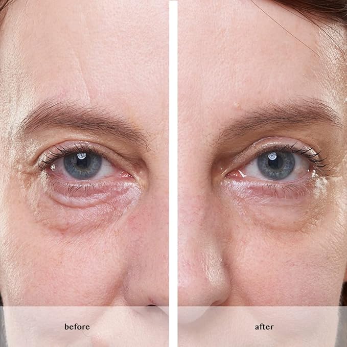Avon ANEW Platinum Instant Eye Smoother for under eye bags/puffiness/wrinkles - Used Open seal-Velvo Beauty
