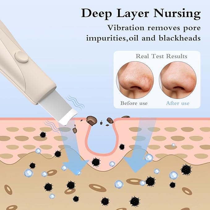 Skin Scrubber Face Spatula Skin Spatula Pore Cleaner Blackhead Remover Tools for Facial Deep Cleansing Skin Care Tool for Men and Women (Beige)-Velvo Beauty
