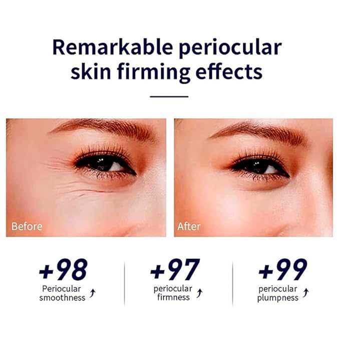 Snail Peptide Eye Cream Non-Sticky Snail Mucin Eye Care Hydrating Essence with 360° Massage Ball for Reducing Dark Circles/Puffiness/Fine Lines, Moisturizing, Firming, Adding Skin Elasticity-Velvo Beauty