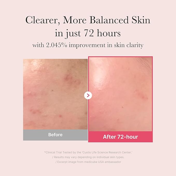 medicube TXA+Niacinamide 15% Glow Facial Serum for After Spot Care | All-in-One Daily Korean Skincare | Uneven Skin Tone, Texture, and Hydration Care | High-Potency Tranexamic Acid 5% | 1.01 fl.oz-Velvo Beauty