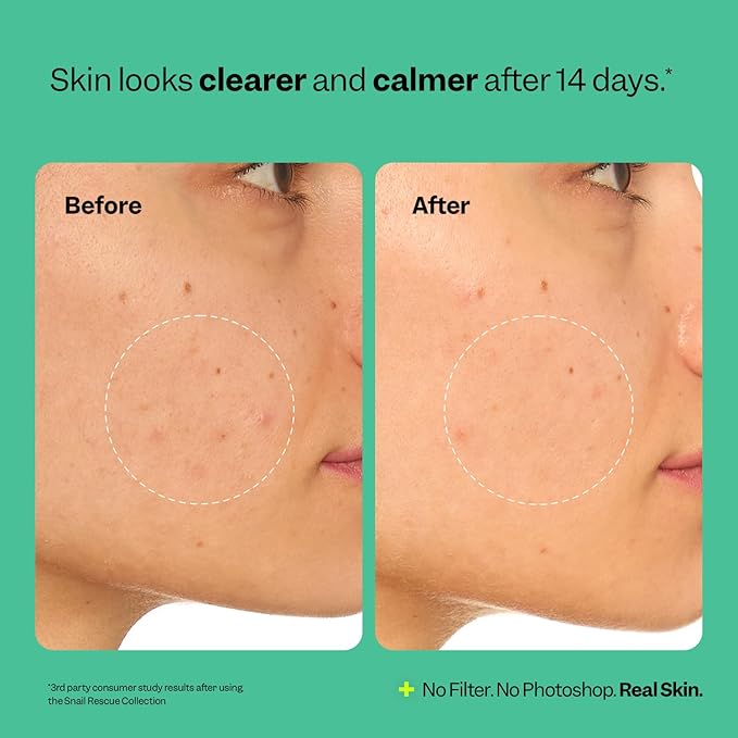 Peach Slices | Snail Rescue Intensive Treatment Wash-Off Face Mask | 95% Snail Mucin | For Dark Spots & Blemishes | Refreshing & Calming Mask | Clear, Radiant, & Hydrated Skin | Skin Care | 3.38 oz-Velvo Beauty
