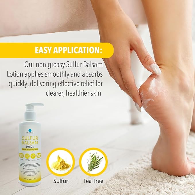 Dr. Robaina Sulfur Balsam Lotion – Lightweight Moisturizer for Dry, Flaky & Itchy Skin – Calms Redness, Supports Skin Barrier & Locks Hydration – Shea Butter & Tea Tree – 8 fl oz, USA Made-Velvo Beauty