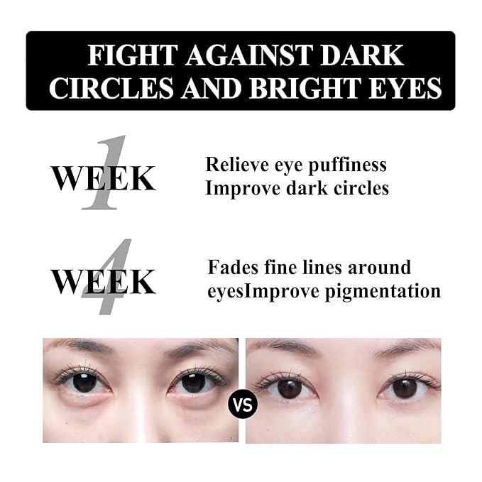 Retinol Snake Venom Peptide Eye Cream, Firming Eye Cream, Anti Ageing Eye Cream, Under Eye Cream For Puffiness and Bags Reduces Fine Lines-Velvo Beauty