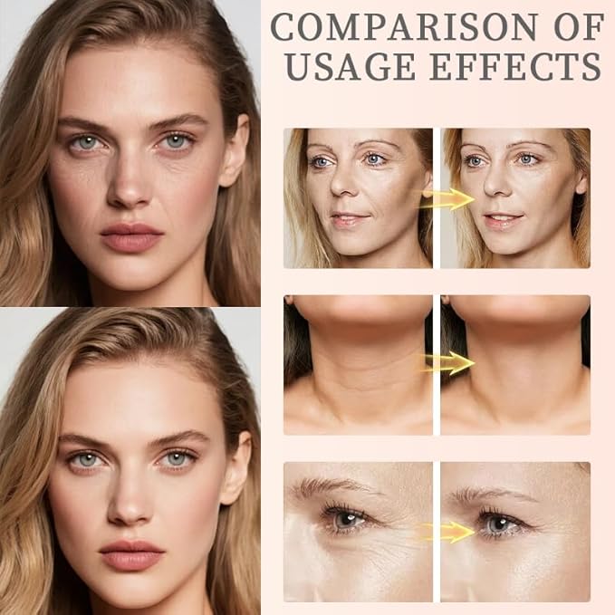 Xianjina Polypeptide Collagen Elastic Essence Cream - Micro-Molecular Anti-Wrinkle Firming Lotion, Tightening & Lifting Sagging Skin for Face, Moisturizing Anti-Aging Treatment (2 Pack)-Velvo Beauty