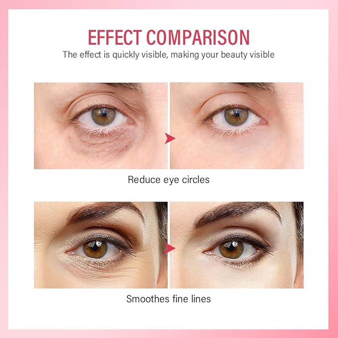 Retinol Eye Retinol Eye Cream for Dark Circles and Puffiness,Anti Aging Eye Cream with Collagen and Hyaluronic Acid,Smoothes Fine Lines,Firms and Lifts Eye Skin,Deeply Moisturizing-Velvo Beauty