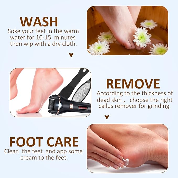 Electric Callus Remover for Feet,Rechargeable Foot File Hard Skin Remover,Waterproof 14 in1 Professional Pedicure Kit for Cracked Heels &Dead Skin,with 9 Roller Heads 2 Speed-Velvo Beauty