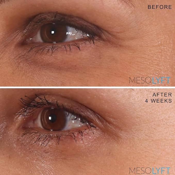Anti-Aging Serum with Neck & Eyes Combo Skincare Face Serum Reduce Signs of Aging Roller for Face An Effective Treatment for Neck and Eyes-Velvo Beauty