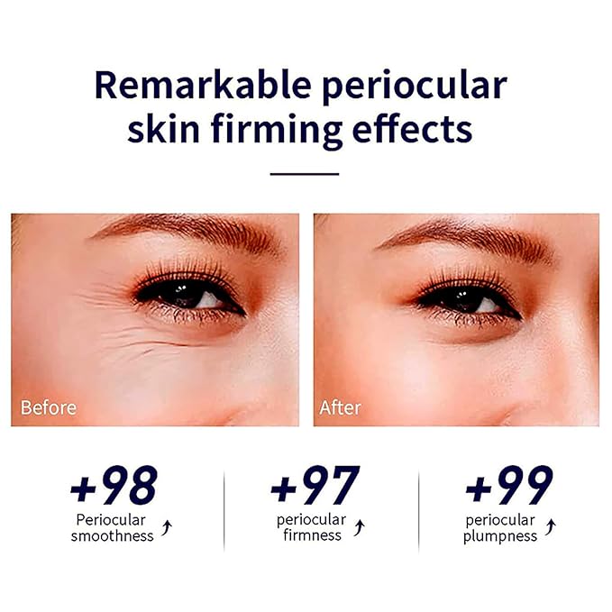 Snail Peptide Advanced Under Eye Cream for Dark Circles, with 360° Massage Ball Reduces Wrinkles &Fine Lines, Eye Essence Roll-On, Firms, Moisturizes, and Tightens Puffy Eyes for Men&Women-Velvo Beauty