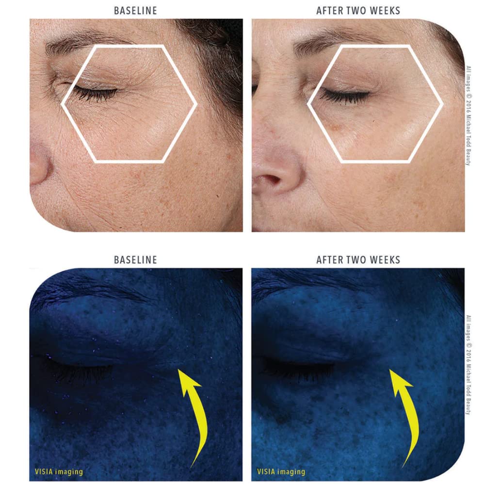 MICHAEL TODD Beauty KNU Cream – Face Lifting, Brightening & Tightening Cream – For Moisturizing & Rejuvenating – With Bakuchiol, Peptides & Snail Secretion – For All Skin Types – 1.68 fl oz/50 mL-Velvo Beauty